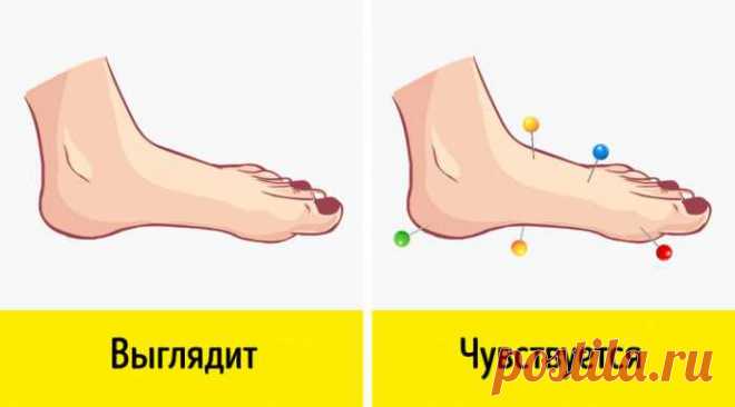 7 неочевидных симптомов, говорящих о том, что у вас нарушено кровообращение — Домашние