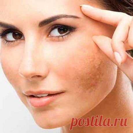 Эта маска "сотрет" пигментные пятна с лица, как ластик