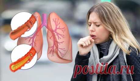Устранение слизи и мокроты из горла и груди - Мгновенный результат Мокрота в горле или заложенность носа являются наиболее распространенной причиной кашля и затруднения дыхания. Мокрота, накопленная в легких, способствует этим проблемам со здоровьем. Хотя эта проблема не угрожает жизни, она влияет […]