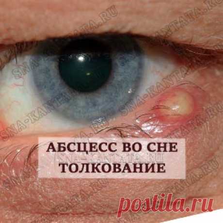 Абсцесс во сне. Толкование