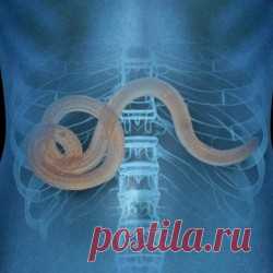 10 признаков того, что у вас могут быть паразиты!