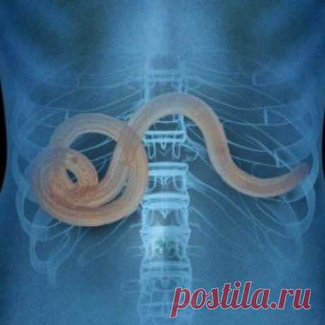10 признаков того, что у вас могут быть паразиты!