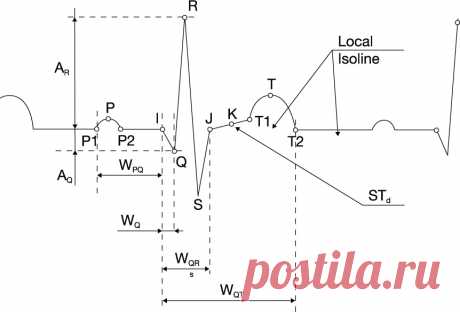 BORSAM Medical Instruments CO., Ltd-ecg holter,pc ecg,stress ecg,monitor,resting ecg

ECG_REF