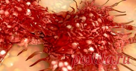 Метаболическая модель рака: Какие продукты «кормят» рак Метаболическая модель рака: Какие продукты «кормят» рак Возможно ли, что хромосомные повреждения – это просто маркер рака, а не фак...