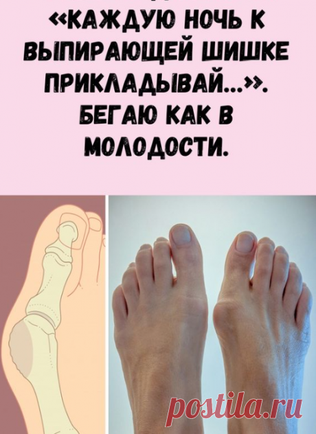 Косточки на ногах — это причина страданий многих женщин. Боль при ходьбе, дискомфорт при ношении обуви, некрасивый внешний вид, деформация пальцев — неприятные спутники растущей шишки.
Народная медицина имеет свой взгляд на решение этой досадной проблемы.
салаты на Пасху
Как избавиться от косточки на ноге
Причин косточки на большом пальце (вальгусной деформации пальца стопы)целый ряд: слишком тесная обувь, неправильное питание, наследственность, плоскостопие, ревматизм.