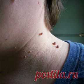 (6) Одноклассники
