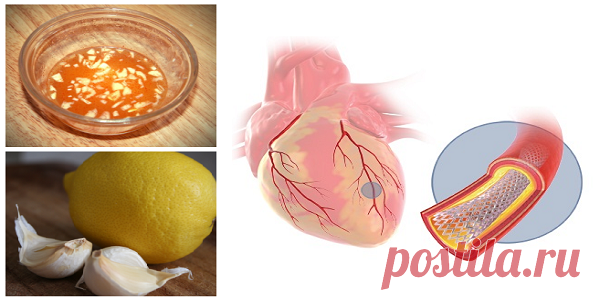 Смесь лимона с чесноком: идеально подходит для расчистки сосудов сердца Будьте здоровы! Вы все знаете, что лимонный сок и чеснок имеют полезные свойства для нашего общего состояния здоровья. Вы можете только представить, насколько мощн�…