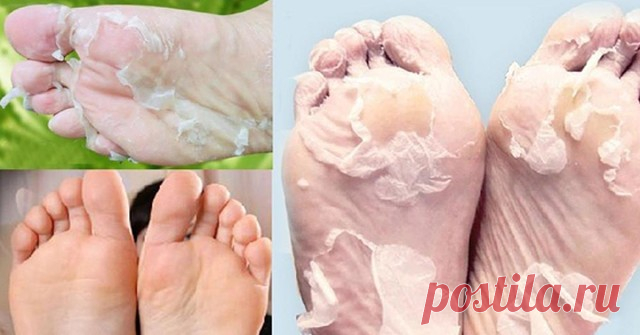 Супер средство для идеальных пяточек!