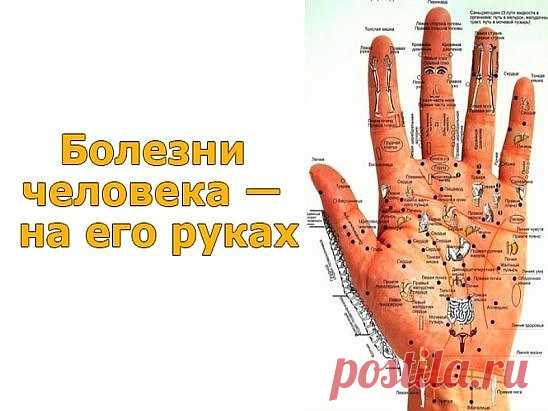 (62) Одноклассники