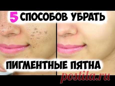 Как Избавиться от ПИГМЕНТНЫХ ПЯТЕН? ✅5 Способов Убрать ПИГМЕНТНЫЕ ПЯТНА в Домашних Условиях