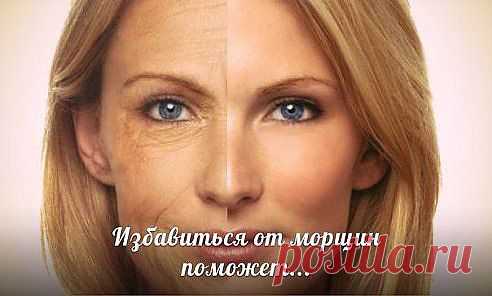 Одноклассники