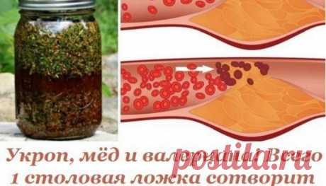 Укроп, мед и валериана! Всего 1 столовая ложка сотворит чудо с твоими сосудами… - Все про все