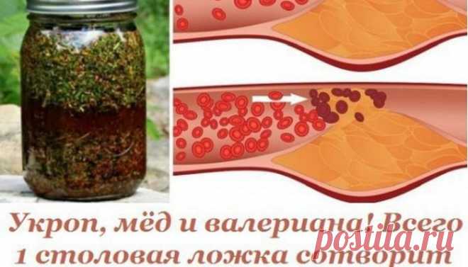 Укроп, мед и валериана! Всего 1 столовая ложка сотворит чудо с твоими сосудами… - Все про все