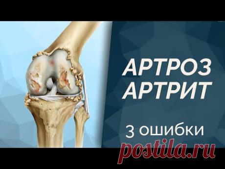 3 ошибки в лечении Артроз и Артирт