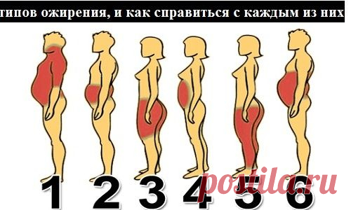 6 ТИПОВ ОЖИРЕНИЯ, И КАК СПРАВИТЬСЯ С КАЖДЫМ ИЗ НИХ....