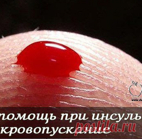 Здоровье. Удивительный и нетрадиционный способ спасения от инсульта - 18 Сентября 2020 - NewRezume.org