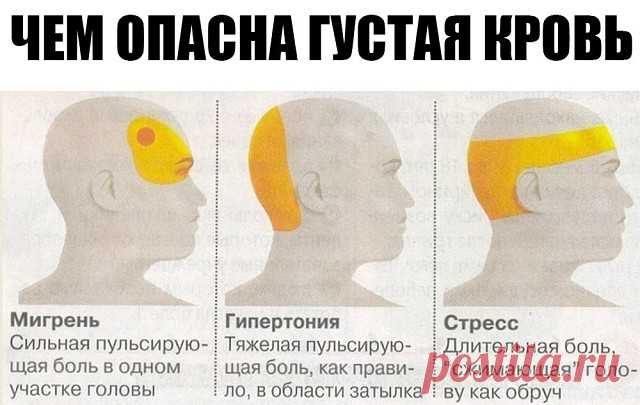 ЧЕМ ОПАСНА ГУСТАЯ КРОВЬ И ЧТО НАДО ДЕЛАТЬ?
Некоторые знают, что густую кровь надо разжижать. Замедленный кровоток приводит к кислородному голоданию внутренних органов. И к возможному образованию тромбов.
Итак, что нужно делать, чтобы кровь свободно циркулировала. Несколько простых советов.
Профилактика образования тромбов
1. Пейте больше воды! 90% людей пьют очень мало воды. Речь именно о кипяченой природной воде, а не о жидкостях. Взрослый человек должен выпивать ежедневн...
