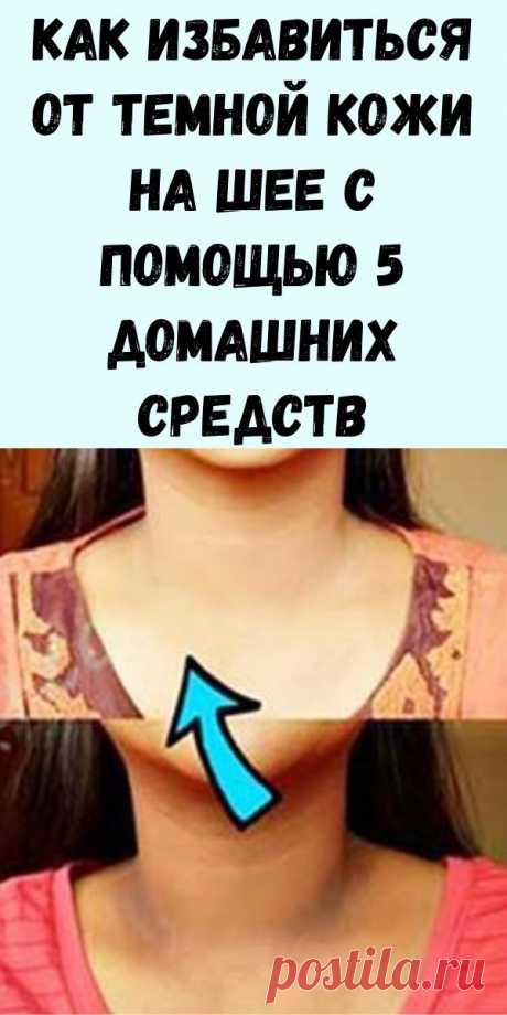 Как избавиться от темной кожи на шее с помощью 5 домашних средств - Упражнения и похудение