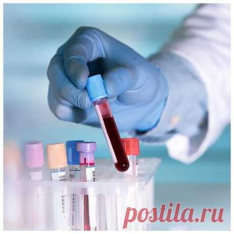 ТОП-5 анализов, которые могут спасти жизнь - ПолонСил.ру - социальная сеть здоровья - 7 июня - Медиаплатформа МирТесен Многие опасные заболевания на начальных стадиях протекают бессимптомно. Вы можете быть уверены, что совершенно здоровы и чувствовать себя отлично, а патологические процессы уже начинают развиваться. Но наша кровь крайне чувствительна к любым изменениям в организме. Абсолютное большинство - 7 июня - 43965121684 - Медиаплатформа МирТесен