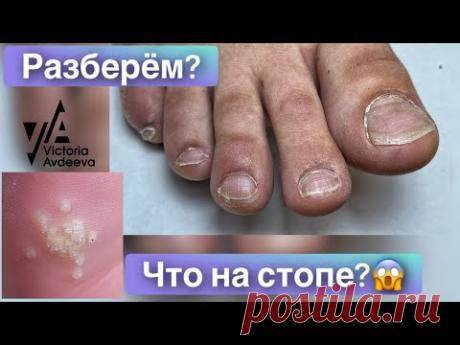 Педикюр онлайн. Виктория Авдеева. Nail art