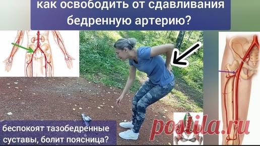 Главная артерия ноги зажимается, не может кормить тазобедренные суставы и колени. Методы декомпрессии | Причины Здоровья | Дзен