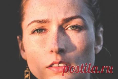 Откуда берутся белые пятна на коже — и как от них избавиться - Lifter