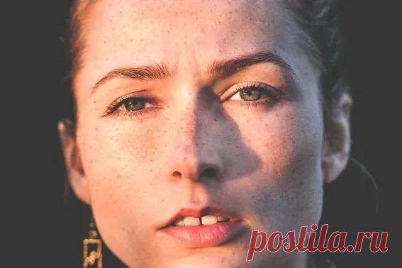 Откуда берутся белые пятна на коже — и как от них избавиться - Lifter