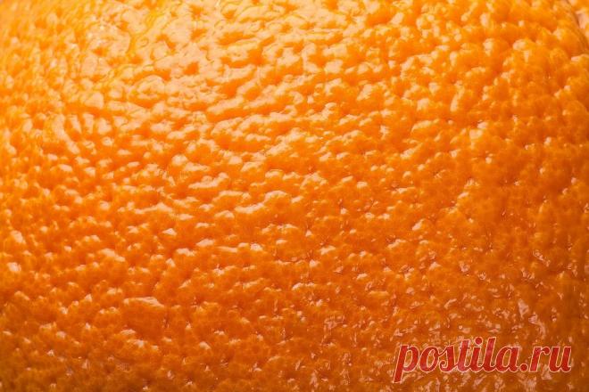 ​5 важных правил для борьбы и профилактики целлюлита — Модно / Nemodno