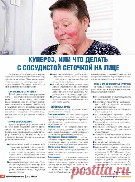 Купероз или что делать с сосудистой сеточкой на лице