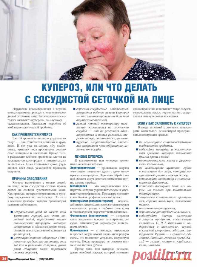 Купероз или что делать с сосудистой сеточкой на лице