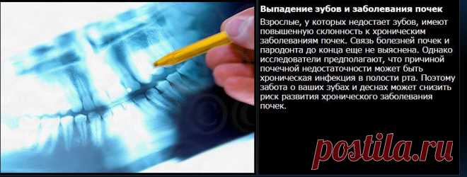 Рот и ваше здоровье..