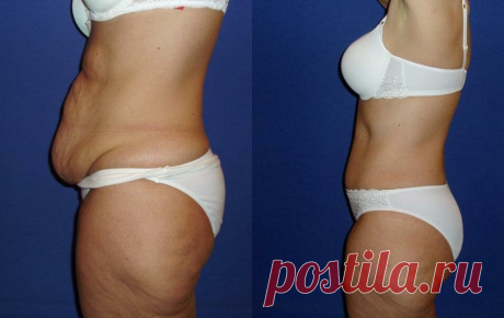 Упражнение "крокодил" для быстрого похудения в области живота | Секреты похудения | Яндекс Дзен