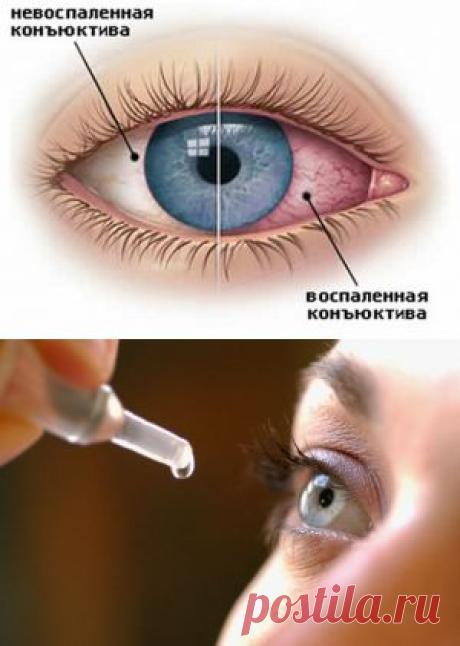 Воспаления глаз: советы народной медицины