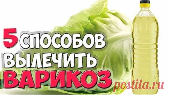Как Лечить ВАРИКОЗ? ✅5 Способов Лечения ВАРИКОЗА Вен Народными Средствами