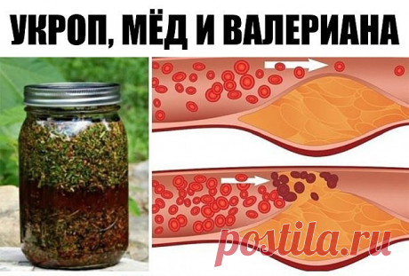Укроп, мёд и валериана! Всего 1 столовая ложка сотворит чудо с твоими сосудами.

К сожалению, наши кровеносные сосуды имеют свойство загрязняться. Они накапливают на своих стенках отложения неорганических солей, что в дальнейшем является причиной развития атеросклероза, нарушения кровообращения, повышенного давления и варикоза.

Поэтому рекомендуется регулярно проводить курс очищения кровеносной системы. Сегодня наша редакция поделится с тобой проверенным методом очищения ...