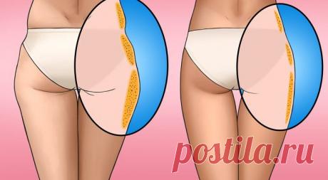Как убрать «ушки» на бедрах, которые портят фигуру - Образованная Сова