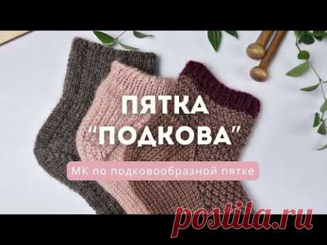 Пятка подкова или подковообразная пятка