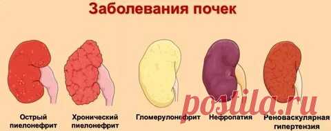 ВСЕ БОЛЕЗНИ: ПОЧЕК: 2 тыс изображений найдено в Яндекс Картинках