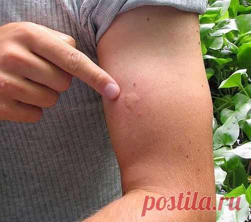 Чудодейственное средство от комаров