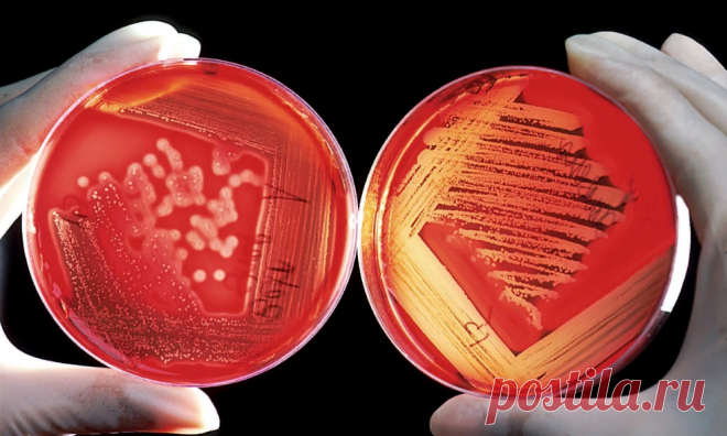 Компоненты, которые не должны присутствовать в натуральной косметике | ПРЕ красно! | Яндекс Дзен