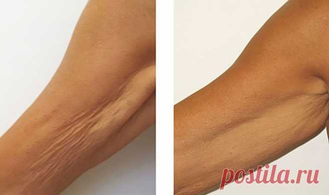 Подтянем дома