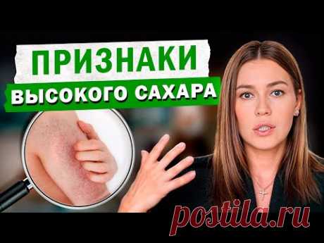 Как быстро распознать повышение САХАРА в КРОВИ? / Признаки повышенной ГЛЮКОЗЫ