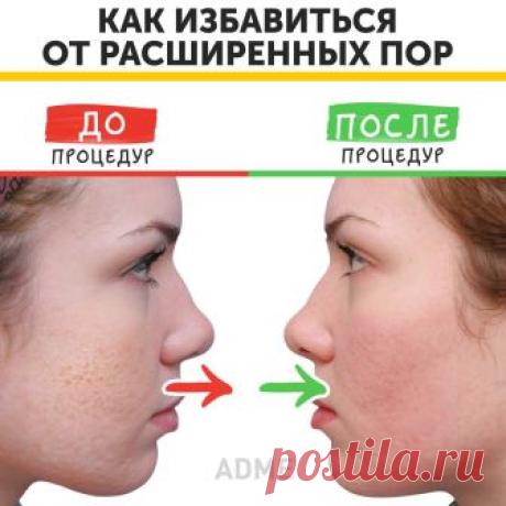 (7) Facebook