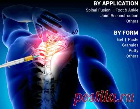 In 2021, the U.S. Bone Void Fillers Market was worth USD 1.17 billion. The market is anticipated to expand at a CAGR of 6.5% from 2022 to 2029, rising from USD 1.33 billion to USD 2.06 billion.