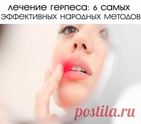 ЛЕЧЕНИЕ ГЕРПЕСА: 6 САМЫХ ЭФФЕКТИВНЫХ НАРОДНЫХ МЕТОДОВ
Зная эти простые советы, ты больше не будешь переживать из-за своего внешнего вида во время обострения инфекции герпеса: мы открыли секрет, чем лечить герпес в домашних условиях.
Герпес на губах или то, что мы называем простудой кожи лица с давних времен известно человечеству. Герпес-это простой вирус, живущий в человеческом организме который иногда дает знать о себе.
Перекись водорода
Если на губе уже успели выскочить волдыри, лучше всего п