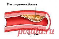 холестерин в крови | Рецепты народной медицины