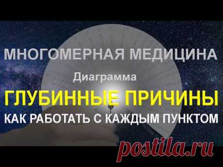 Описание диаграммы глубинных причин. Часть 1. Как работать с каждым пунктом. - YouTube