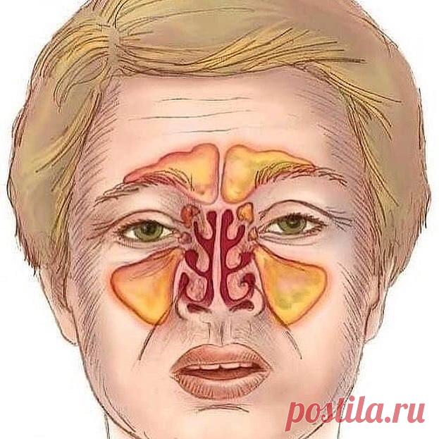 Photo by Рецепты здоровья и красоты! on April 17, 2020. Нет описания фото.