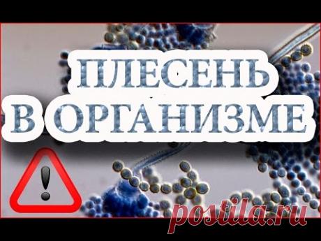 Плесень в организме и действие соды - Огулов А Т