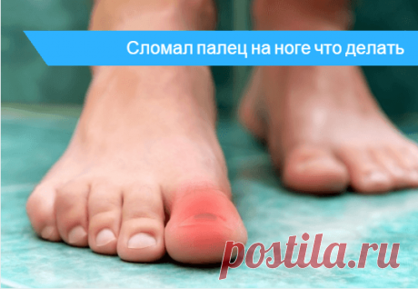 Что делать если сломал палец на ноге 🔎 - первая помощь при переломе 💊 Как быстро вылечить перелом мизинца на ноге 🚑 . Противопоказания при лечении переломов пальцев в домашних условиях.